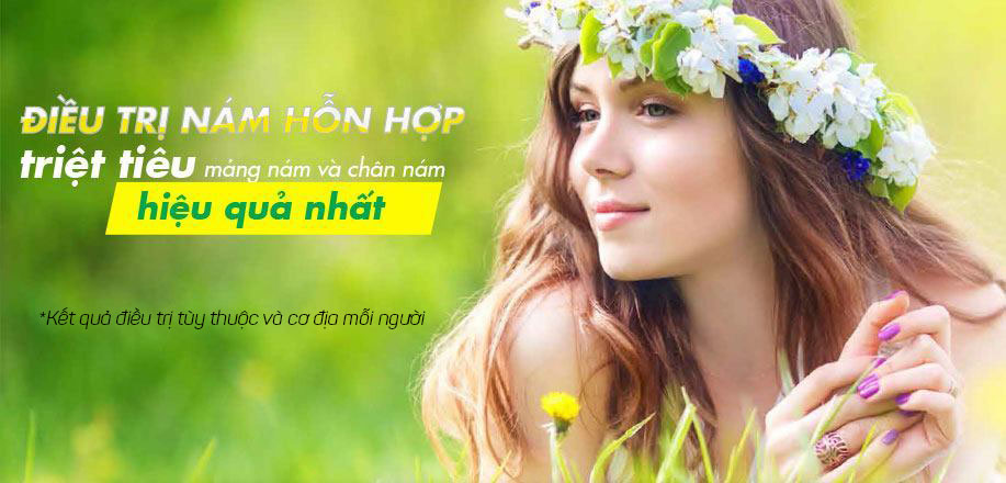 Cách Trị Nám Hiệu Quả Với Công Nghệ Hoa Kỳ