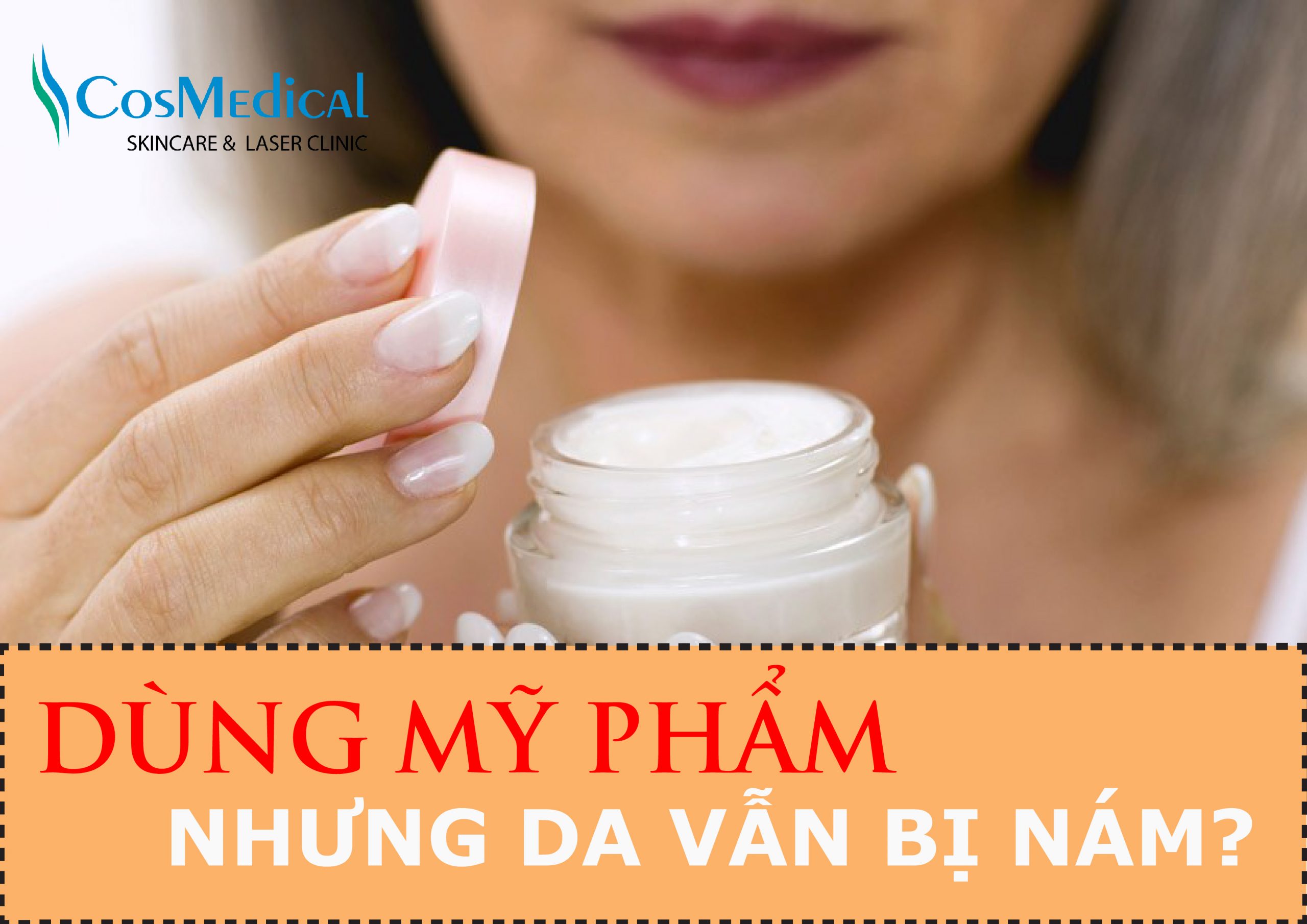 Trị sạch nám bằng mỹ phẩm là không thể