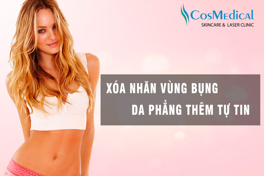 xóa nhăn vùng bụng