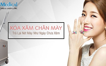 XÓA XĂM CHÂN MÀY THẦN TỐC