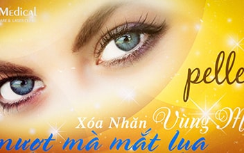 XÓA NHĂN VÙNG MẮT – TRẢ LẠI TUỔI XUÂN